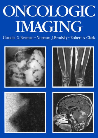 

general-books/general/oncologic-imaging--9780070051140