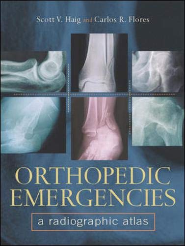 

surgical-sciences/orthopedics/orthopedic-emergencies-a-radiographic-atlas-1-ed--9780071380683