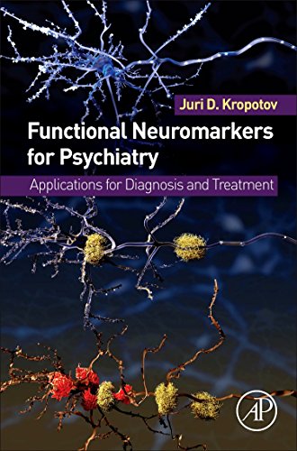 

exclusive-publishers/elsevier/functional-neuromarkers-for-psychiatry-applications-for-diagnosis-and-tre--9780124105133