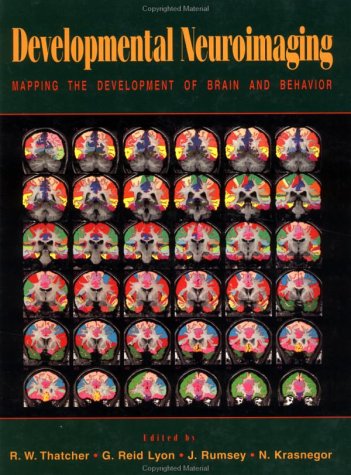 

general-books/general/developmental-neuroimaging--9780126860702