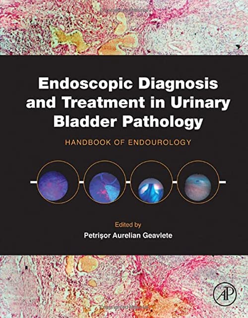 

mbbs/3-year/endoscopic-diagnosis-and-treatment-in-urinary-bladder-pathology-handbook-o-9780128024393