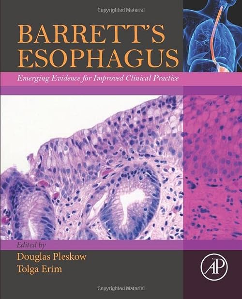 

exclusive-publishers/elsevier/barrett-s-esophagus-emerging-evidence-for-improved-clinical-practice--9780128025116