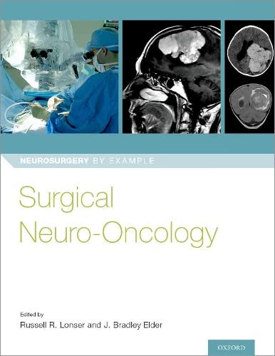 

exclusive-publishers/oxford-university-press/surgical-neuro-oncology--9780190696696