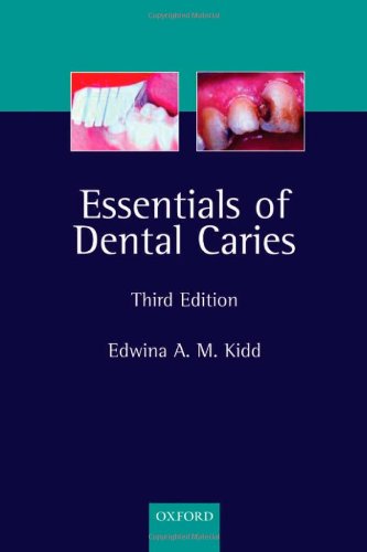 

dental-sciences/dentistry/essentials-of-dental-caries-the-disease-and-its-management-3rd-ed--9780198529781
