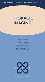 

exclusive-publishers/oxford-university-press/thoracic-imaging-9780198827665