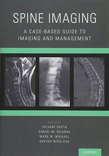 

exclusive-publishers/oxford-university-press/spine-imaging-a-case-based-guide-to-imaging-and-management-9780199393947