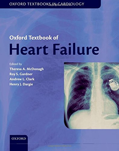 

exclusive-publishers/oxford-university-press/oxford-textbook-of-heart-failure--9780199577729