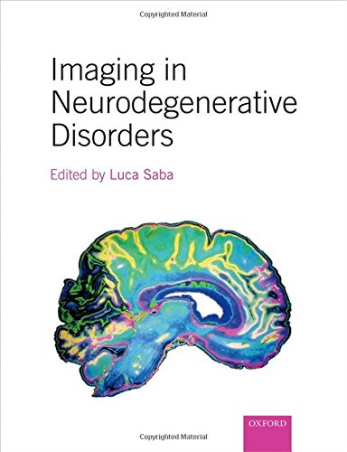 

exclusive-publishers/oxford-university-press/imaging-in-neurodegenerative-disorders--9780199671618