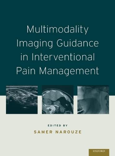 

exclusive-publishers/oxford-university-press/multimodality-imaging-guidance-in-interventional-pain-management-9780199908004