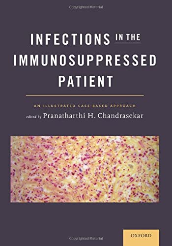 

exclusive-publishers/oxford-university-press/infections-in-the-immunosuppressed-patient-an-illustrated-case-based-approach-9780199938568