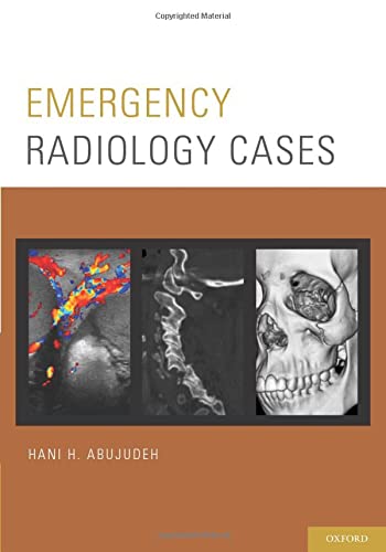 

exclusive-publishers/oxford-university-press/emergency-radiology-cases--9780199941179