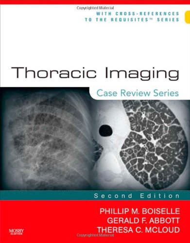 

mbbs/4-year/thoracic-imaging-case-review-series-2e-9780323029995