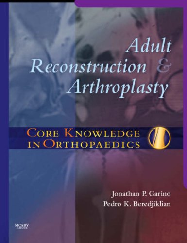 

surgical-sciences/orthopedics/core-knowledge-in-orthopaedics-adult-reconstruction-and-arthroplasty-1e-9780323033701