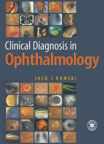 

general-books/general/clinical-diagnosis-in-ophthamology-free-cd-included-1-ed--9780323037617