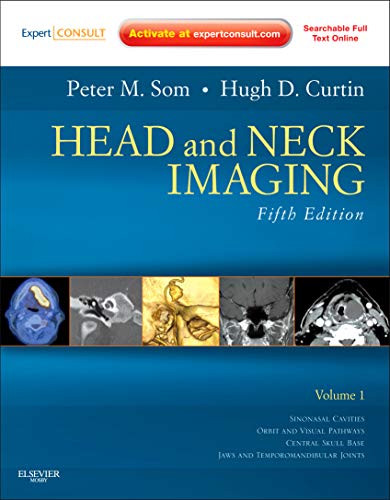 

surgical-sciences//head-and-neck-imaging-5-ed-2-vols-9780323053556
