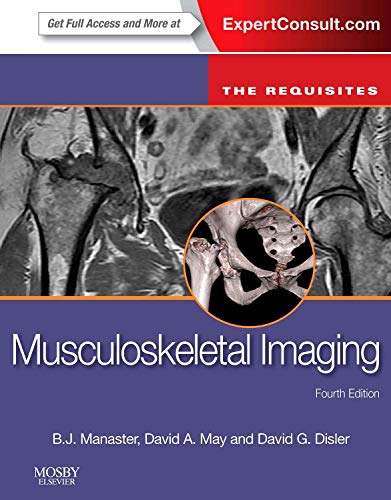 

exclusive-publishers/elsevier/musculoskeletal-imaging-the-requisites-expert-consult--online-and-print-4e--9780323081771