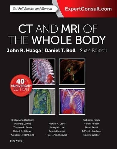 

exclusive-publishers/elsevier/ct-and-mri-of-the-whole-body-6-ed-2-vols--9780323113281