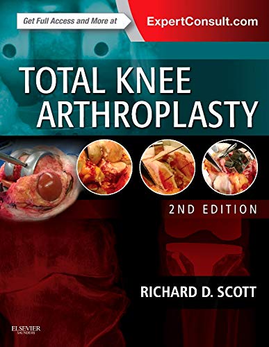 

exclusive-publishers/elsevier/total-knee-arthroplasty-2e--9780323286633