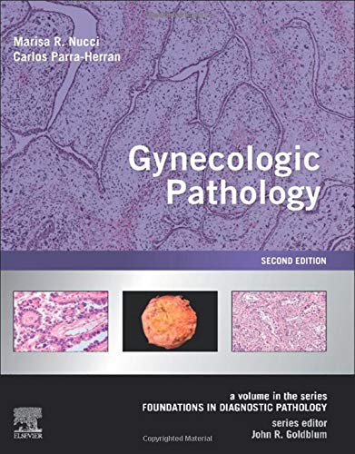 

exclusive-publishers/elsevier/gynaecologic-pathology-a-volume-in-foundations-in-diagnostic-pathology-series-2-ed--9780323359092