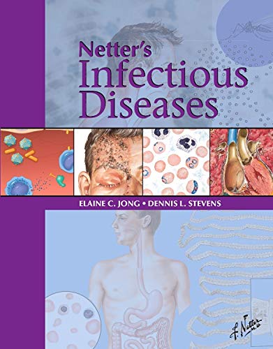 

exclusive-publishers/elsevier/netter-s-infectious-diseases-1e--9780323374743