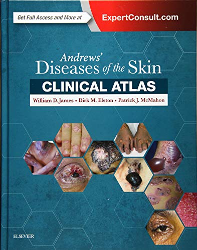 

exclusive-publishers/elsevier/andrews-diseases-of-the-skin-clinical-atlas-1e--9780323441964