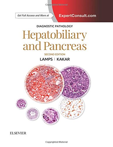 

general-books/general/diagnostic-pathology-hepatobiliary-and-pancreas-2e--9780323443074