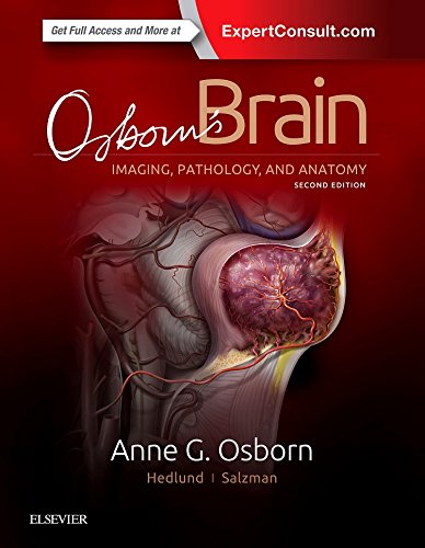 

exclusive-publishers/elsevier/osborn-s-brain-imaging-pathology-and-anatomy-2-ed--9780323477765