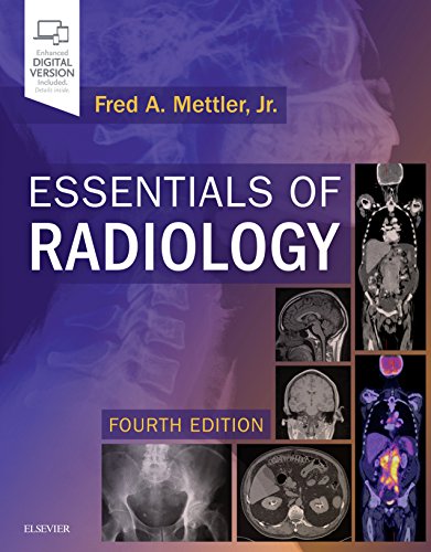

exclusive-publishers/elsevier/essentials-of-radiology-common-indications-and-interpretation-4e--9780323508872