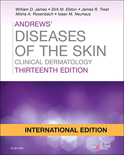 

general-books/general/andrews-diseases-of-the-skin-international-edition-clinical-dermatology-13e-9780323547543