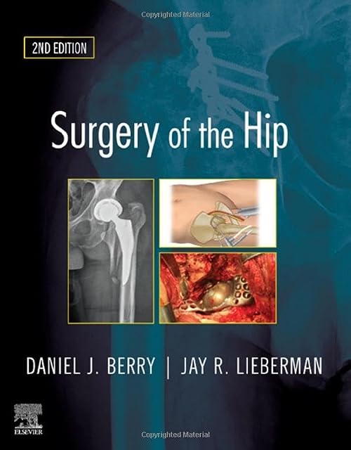 

exclusive-publishers/elsevier/surgery-of-the-hip-expert-consult---online-and-print-2e--9780323554640