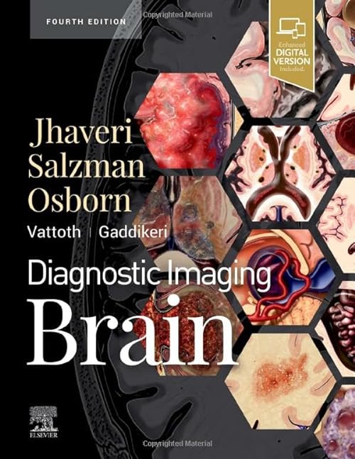 

general-books/general/diagnostic-imaging-brain-4e-9780323756204