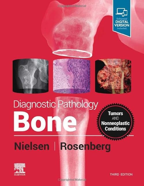 

exclusive-publishers/elsevier/diagnostic-pathology-bone-3e-9780323765336