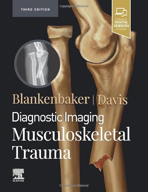 

exclusive-publishers/elsevier/diagnostic-imaging-musculoskeletal-trauma-3e-9780323793933