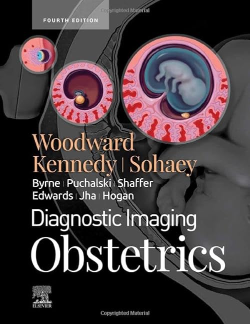 

exclusive-publishers/elsevier/diagnostic-imaging-obstetrics-4e-9780323793964