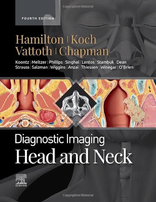

exclusive-publishers/elsevier/diagnostic-imaging-head-and-neck-4ed--9780323796507