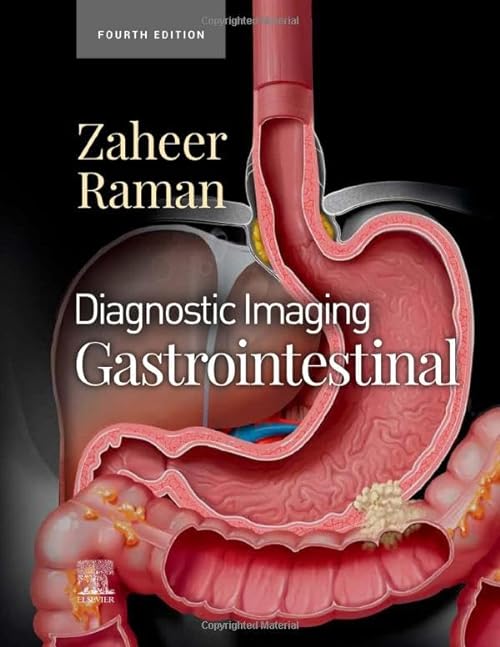 

exclusive-publishers/elsevier/diagnostic-imaging-gastrointestinal-4e-9780323824989