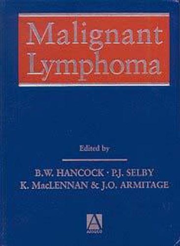 

general-books/general/malignant-lymphoma--9780340742075