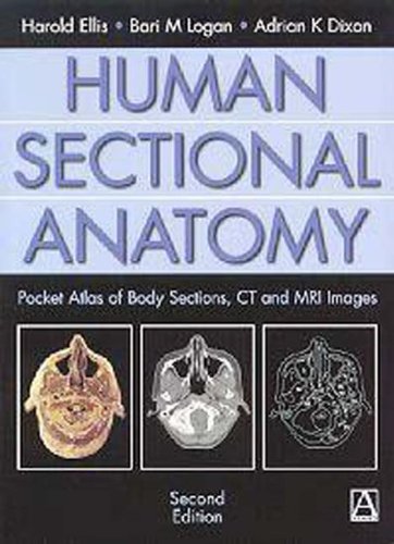 

general-books/general/human-sectional-anatomy-2ed---9780340807644