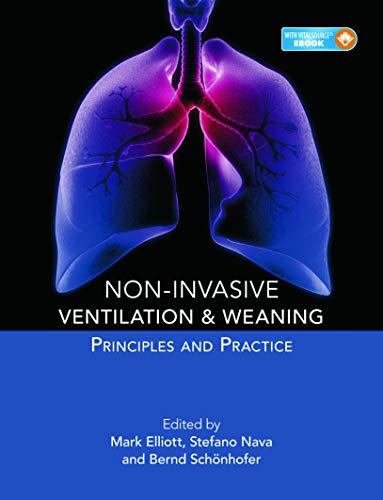 

general-books/general/non-invasive-ventilation-weaning-1-ed--9780340941522