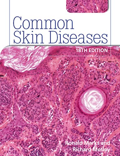 

exclusive-publishers/taylor-and-francis/common-skin-diseases-18th-edition-ise-version--9780340983508