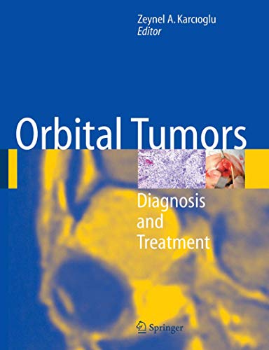 

mbbs/4-year/orbital-tumors-diagnosis-and-treatment-9780387213217