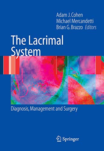 

mbbs/3-year/the-lacrimal-system-diagnosis-management-and-surgery-9780387253855