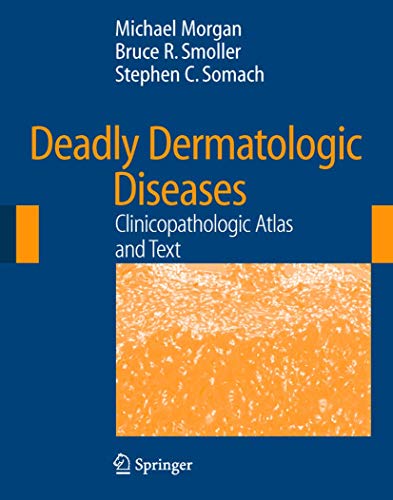 

mbbs/3-year/deadly-dermatologic-diseases-clinicopathologic-atlas-and-text-cd-rom-included-9780387254425