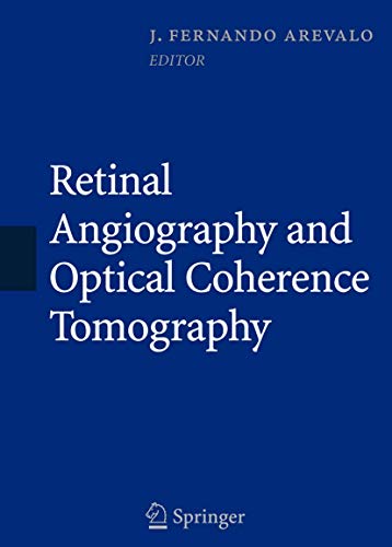 

general-books/general/retinal-angiography-and-optical-coherence-tomography--9780387689869