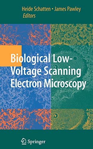 

exclusive-publishers/springer/biological-low-voltage-scanning-electron-microscopy--9780387729701
