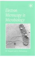 

basic-sciences/microbiology/electron-microscopy-in-microbiology--9780387915647