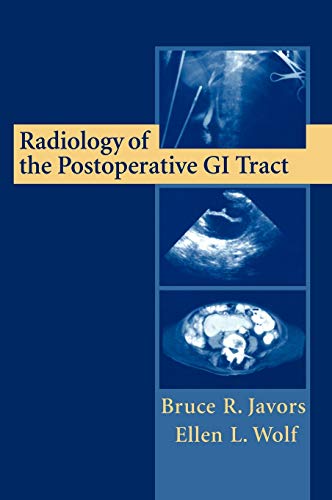 

mbbs/4-year/radiology-of-the-postoperative-gi-tract-9780387952000