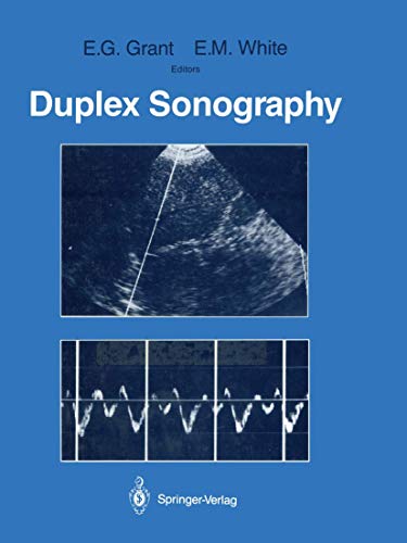 

general-books/general/duplex-sonography--9780387965642