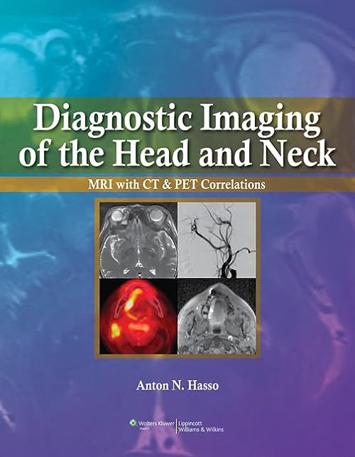 

exclusive-publishers/lww/diagnostic-imaging-of-the-head-and-neck--9780397515370