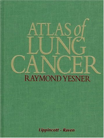 

mbbs/4-year/atlas-of-lung-cancer-9780397516469